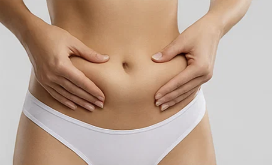 Abdominoplasty